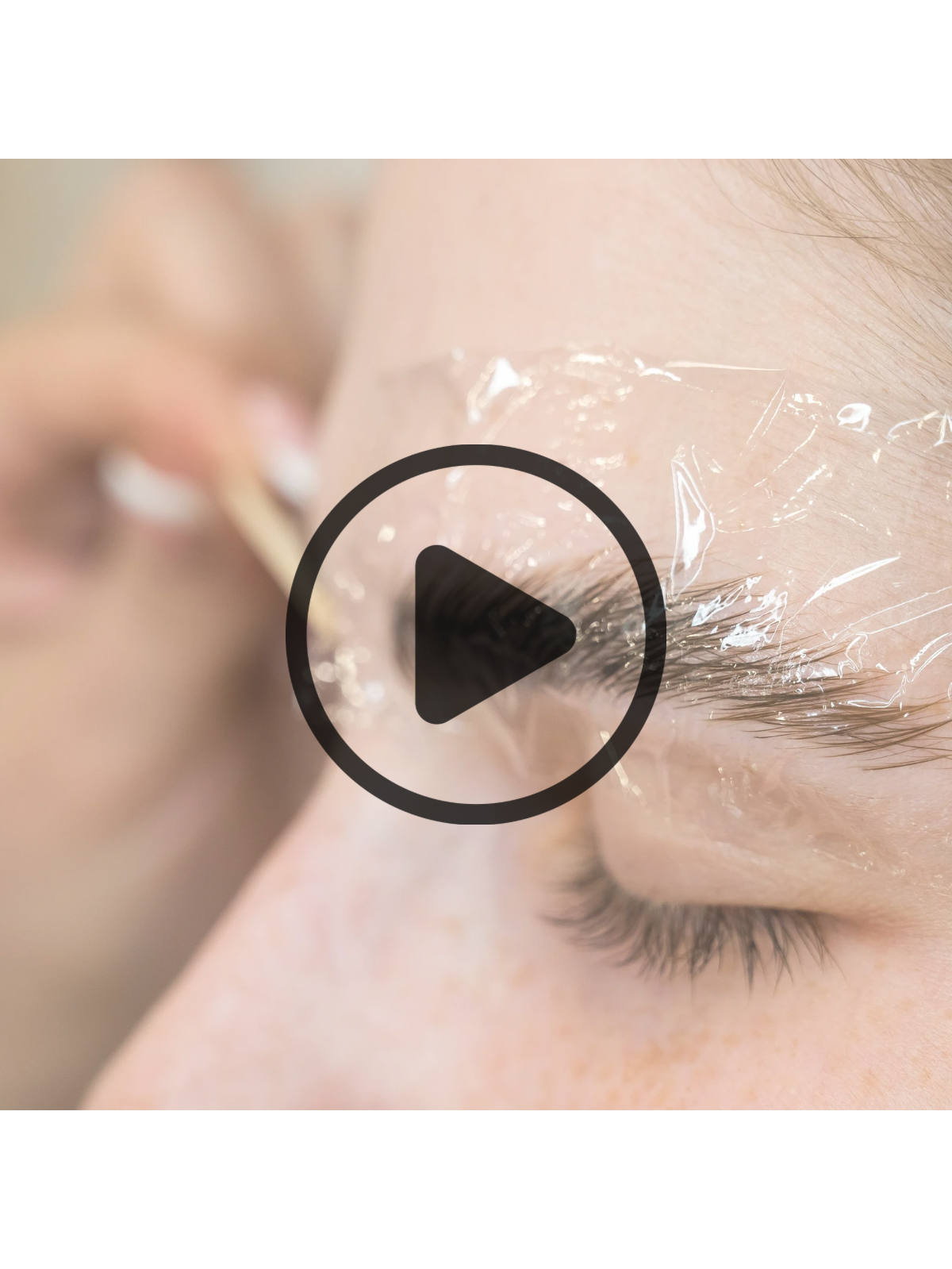 FORMATION BROW-LIFT